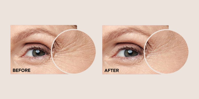 In Article Vitamin C And Hyaluronic Acid HASerum